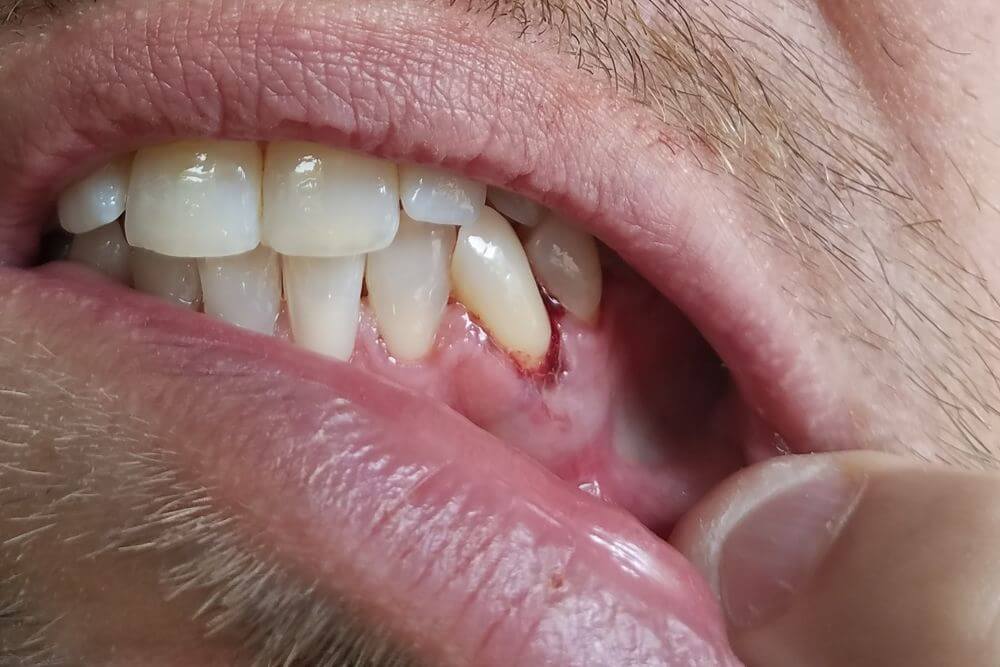 emergency dentist