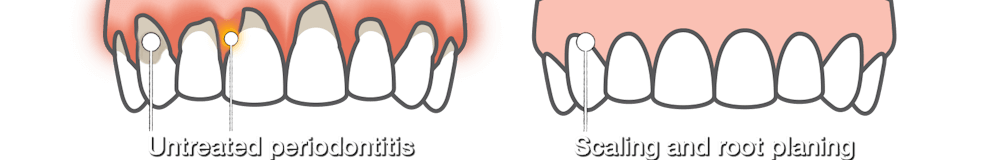 Dentist Carrollwood