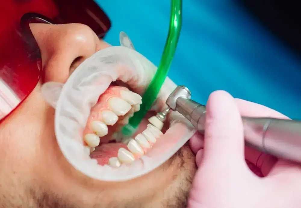 what is a dental deep cleaning