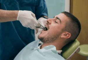 What to Expect During a Tooth Extraction?