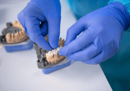 Understanding the Different Types of Dental Crowns!